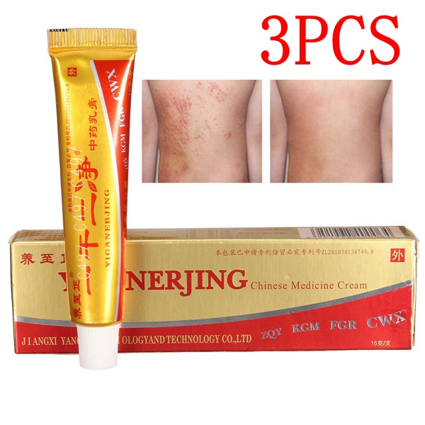  Medicine Cream Eczema Dermatitis Psoriasis Vitiligo Skin Treatment