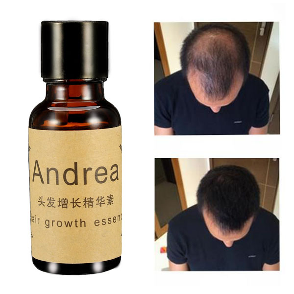 Herbal Fast Hair Growth Essence Liquid 
