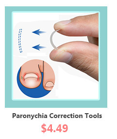 Ingrown Toenail Straightening BS Brace Paronychia Correction Tool