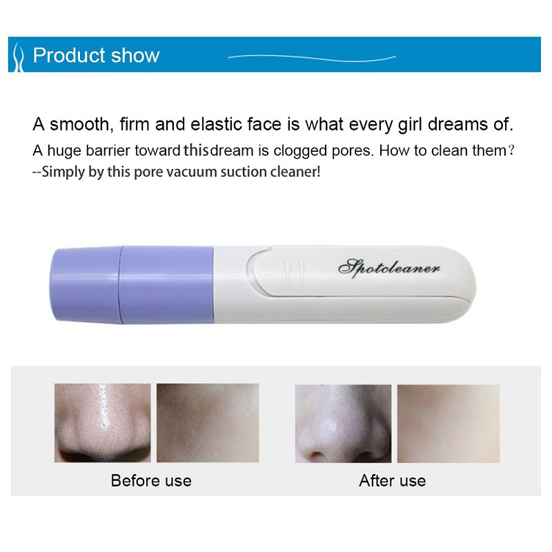 Electric Facial Pore Suction Spot Cleaner Blackhead Remover Acne Pimple Cleanser Lifting Firming Skin