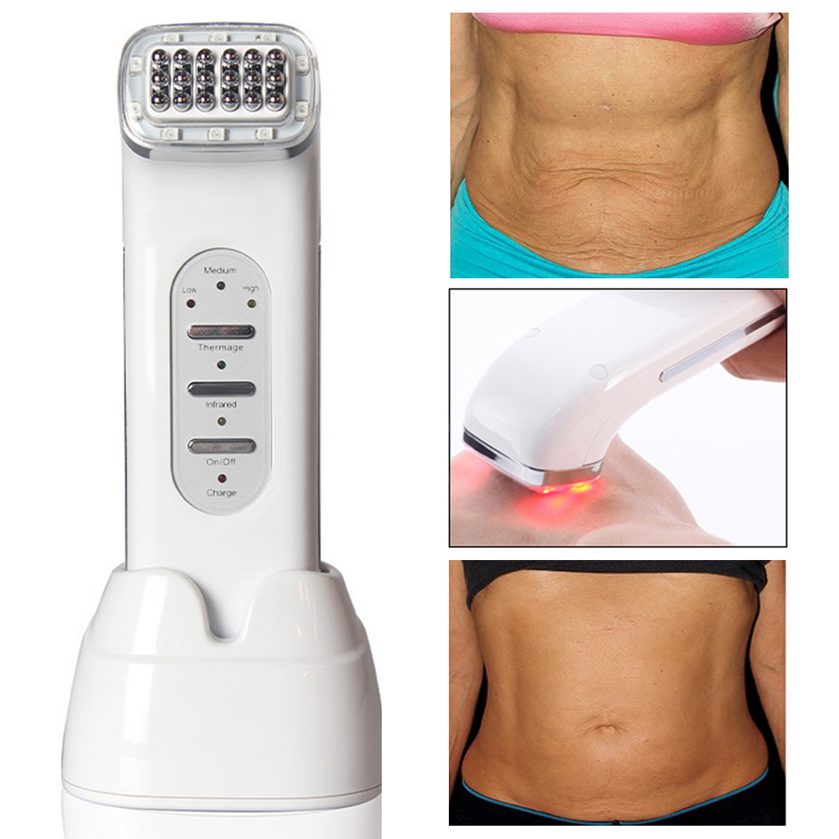 

RF Radio Frequency Rejuvenation Machine Anti Aging Wrinkles Removal Skin Tightening Lifting Beauty