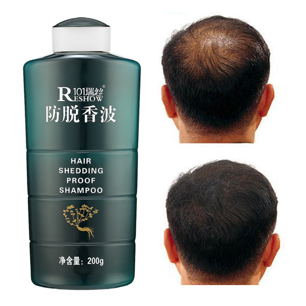 

ZHANGGUANG 101 Herbal Essence Anti Hair Lossing Shedding Alopecia Proof Shampoo Growth