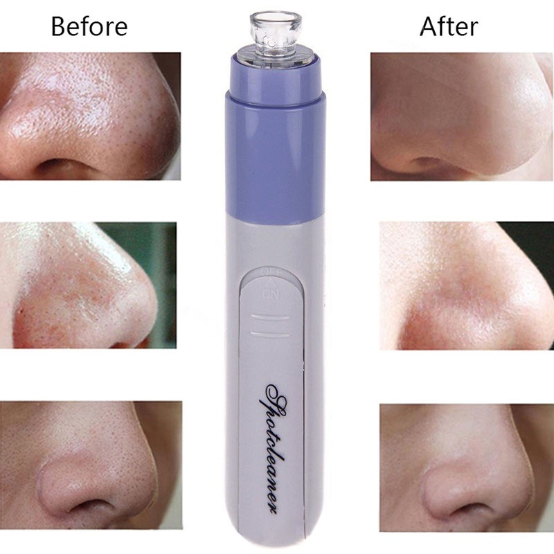Electric Facial Pore Suction Spot Cleaner Blackhead Remover Acne Pimple Cleanser Lifting Firming Skin