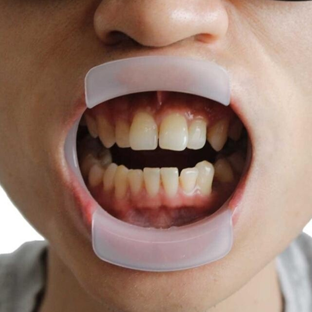 

O-type Dental Teeth Whitening Cheek Retractor Lip Mouth Opener Holder