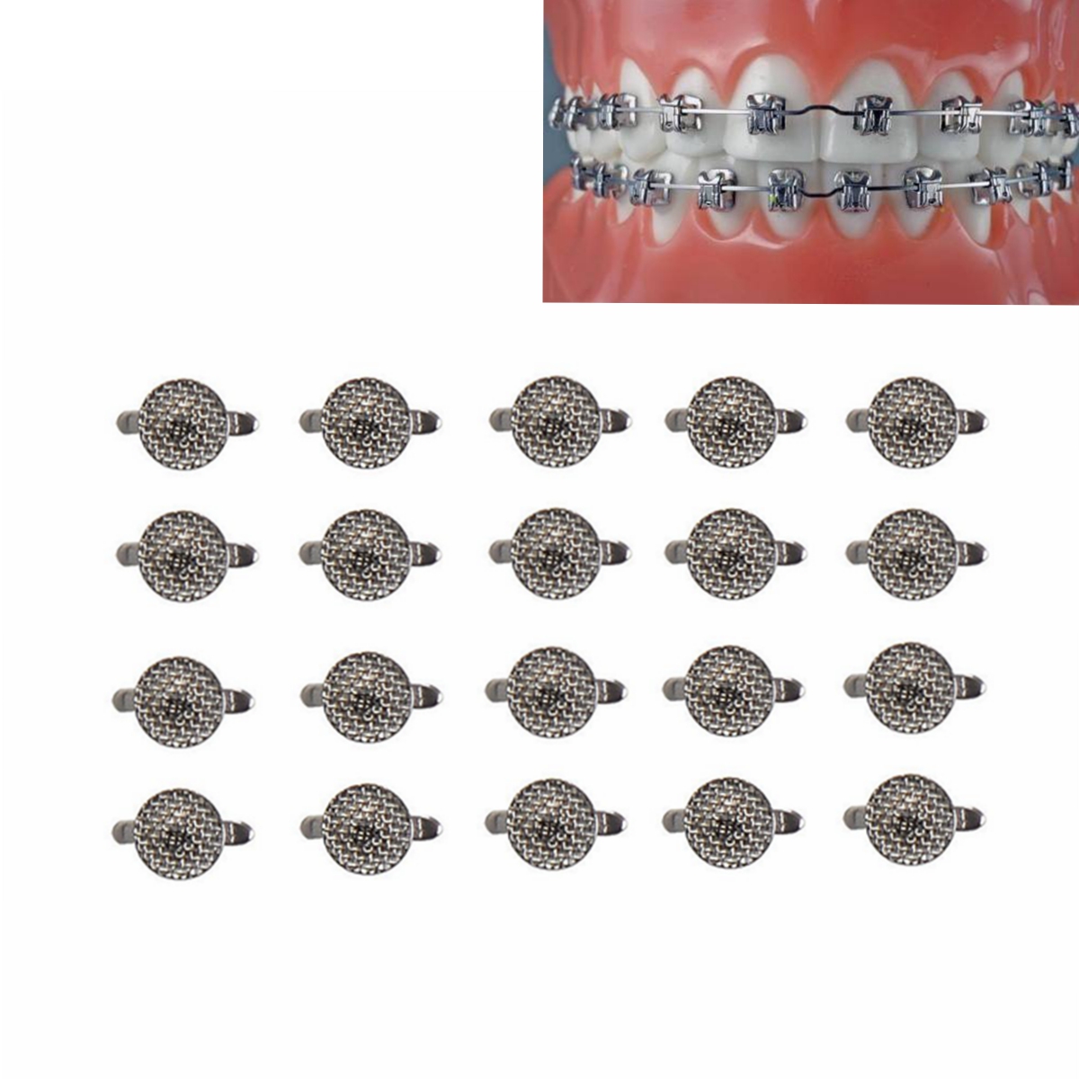 

20pcs Dental Orthodontic Lingual Buttons Bondable Cleat Double Wing Mesh Base