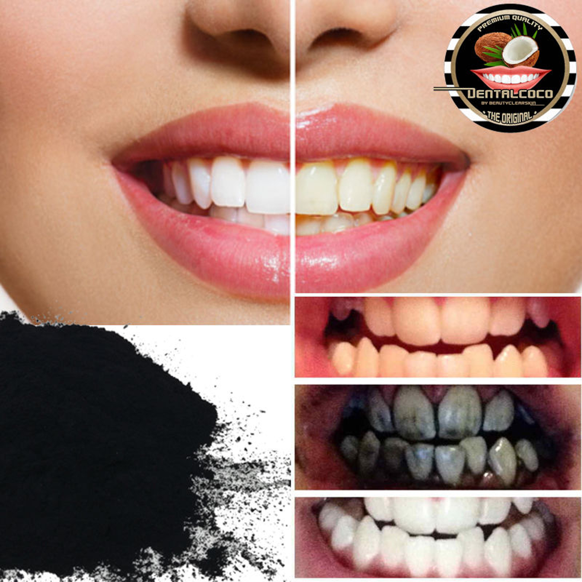 поможет ли уголь для отбеливания зубов