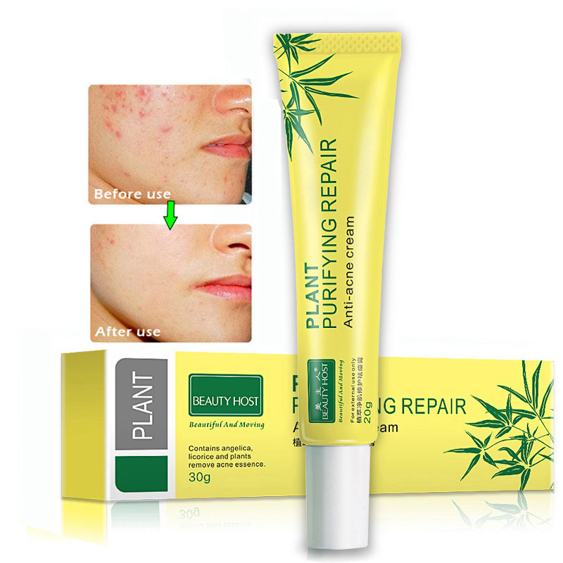 Extrait de plante Extrait de l'acne Creme nettoyante Pores Fade Acne Control Huile Hydratante Creme Soins de la peau